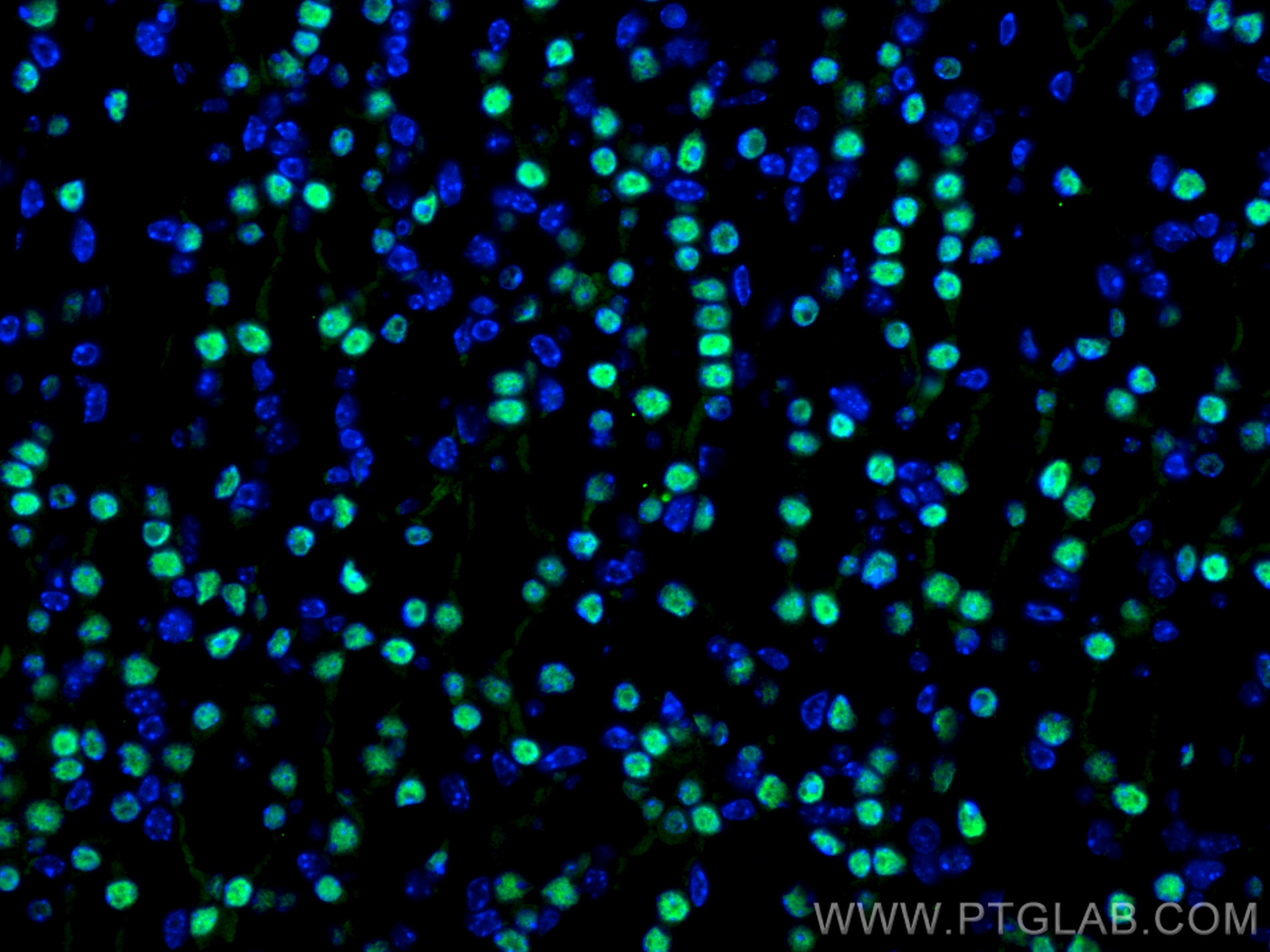 Immunofluorescence (IF) / fluorescent staining of mouse kidney tissue using PAX8 Polyclonal antibody (10336-1-AP)