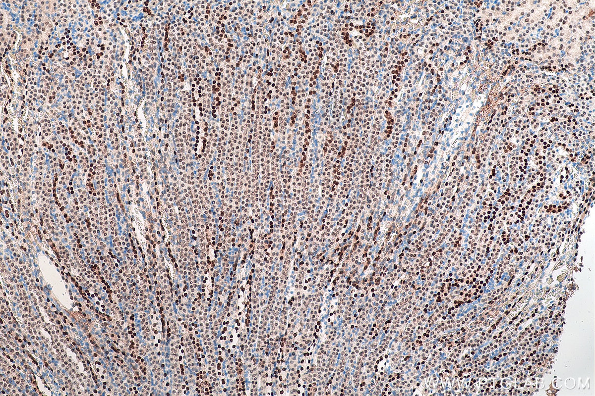 Immunohistochemistry (IHC) staining of mouse kidney tissue using PAX8 Monoclonal antibody (60145-4-Ig)