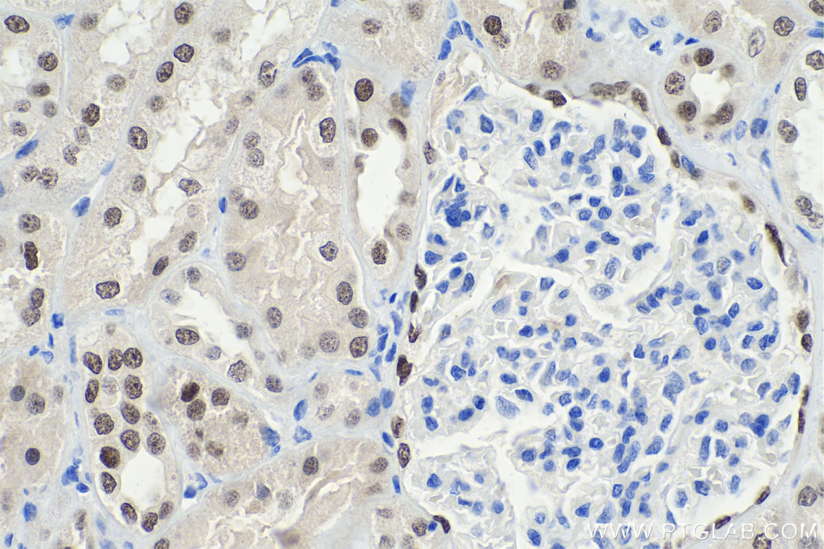 Immunohistochemistry (IHC) staining of human kidney tissue using PAX8 Monoclonal antibody (60145-4-Ig)