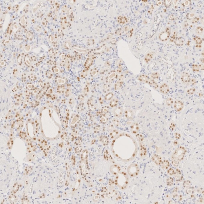 Immunohistochemistry (IHC) staining of human kidney tissue using PAX8 Monoclonal antibody (60145-4-Ig)