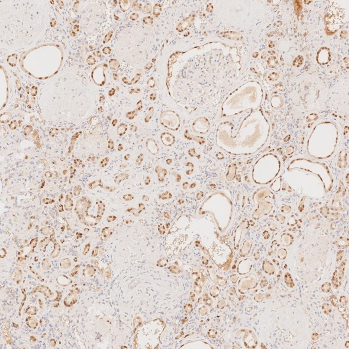 Immunohistochemistry (IHC) staining of human kidney tissue using PAX8 Monoclonal antibody (60145-4-Ig)