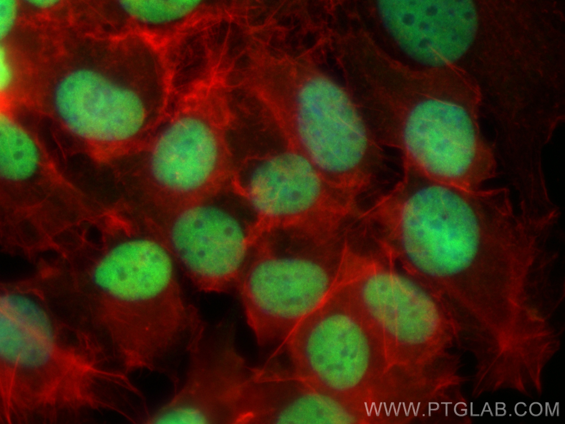 Immunofluorescence (IF) / fluorescent staining of SKOV-3 cells using CoraLite® Plus 488-conjugated PAX8 Polyclonal anti (CL488-10336)