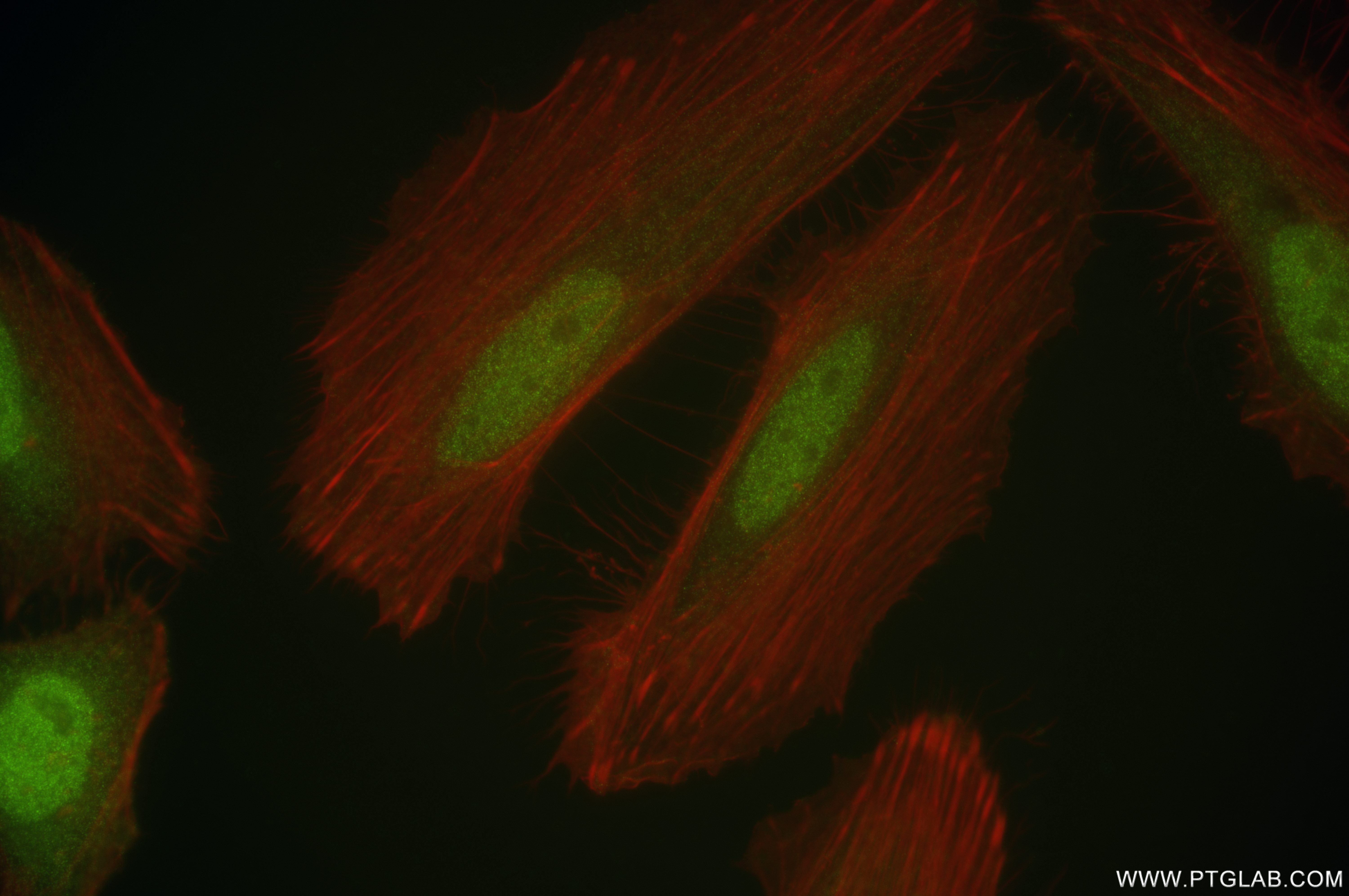 Immunofluorescence (IF) / fluorescent staining of HeLa cells using PBK/SPK Recombinant antibody (84970-1-RR)