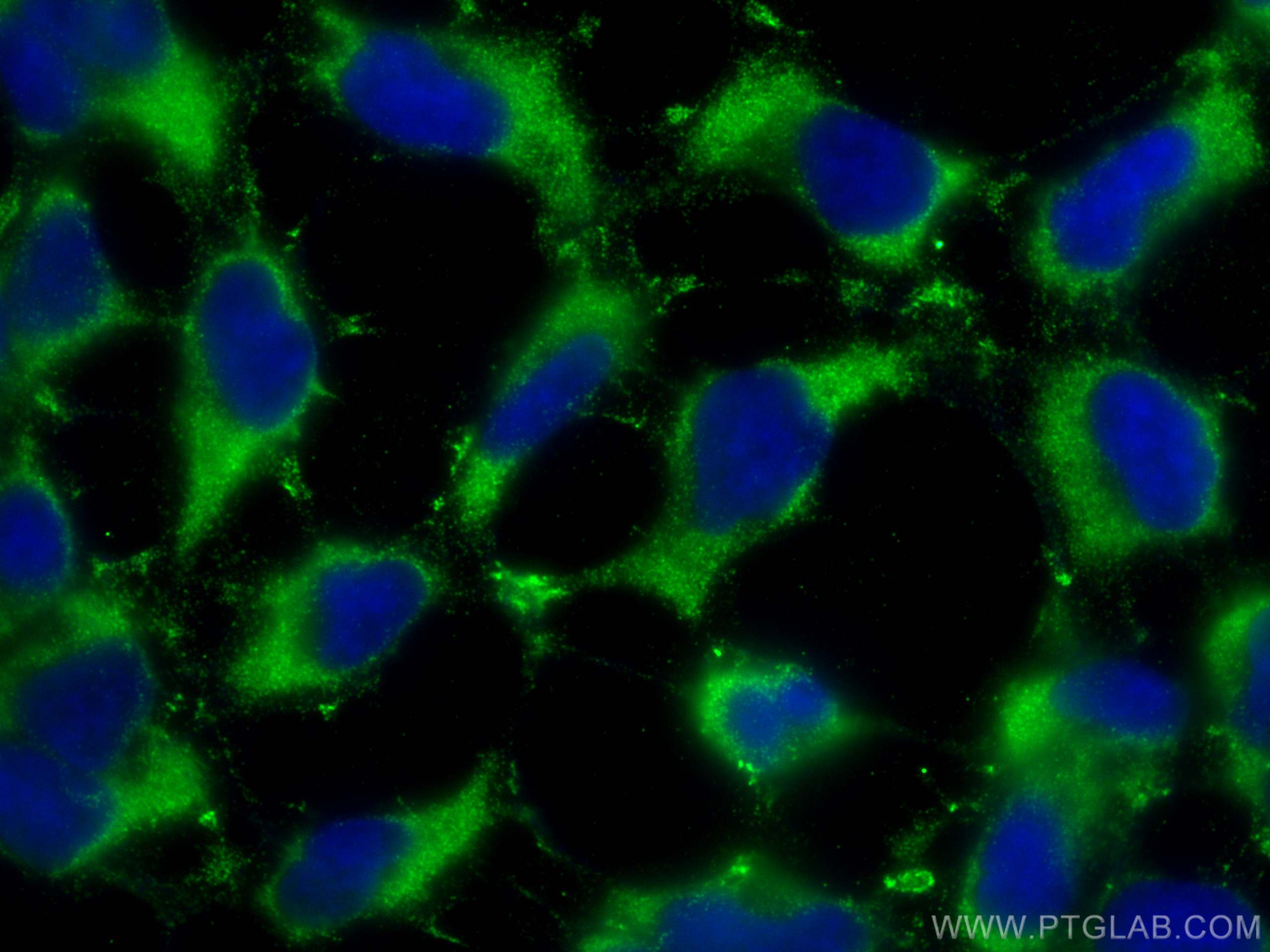 Immunofluorescence (IF) / fluorescent staining of HEK-293 cells using PBLD Monoclonal antibody (68317-1-Ig)