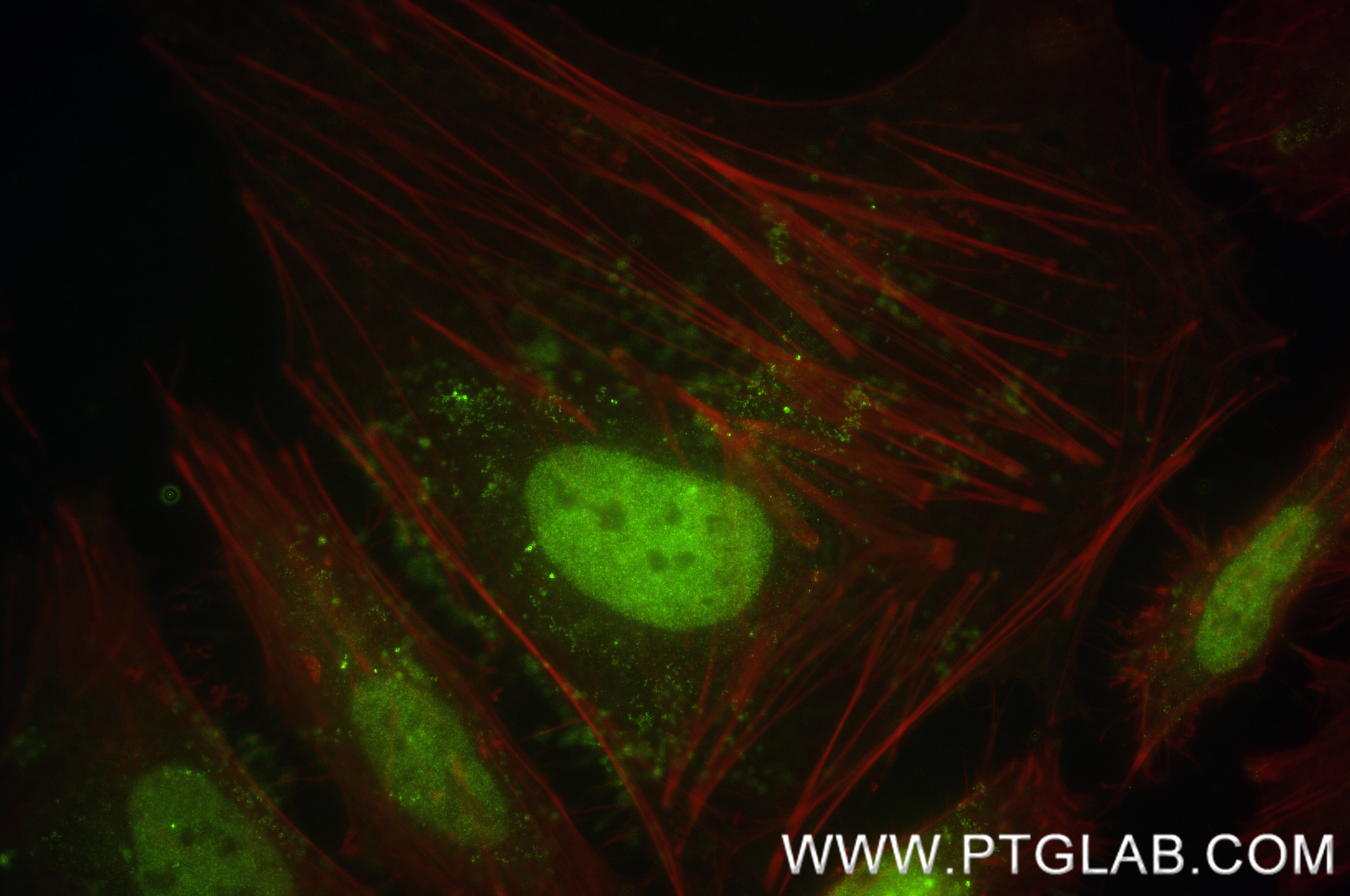 Immunofluorescence (IF) / fluorescent staining of HeLa cells using PBRM1 Recombinant antibody (83677-2-RR)