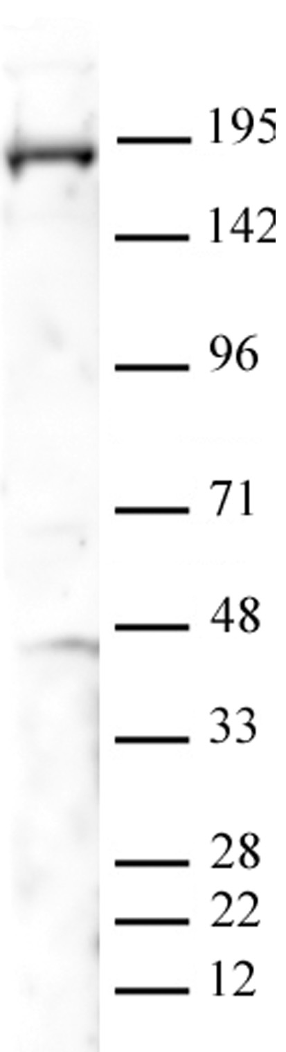 PBRM1 antibody (pAb) tested by Western blot. Detection of PBRM1 by Western blot. The analysis was performed using 40 ug of A-431 nuclear extract (Cat. No. 36004) and PBRM1 (pAb) at a 1:1000 dilution.