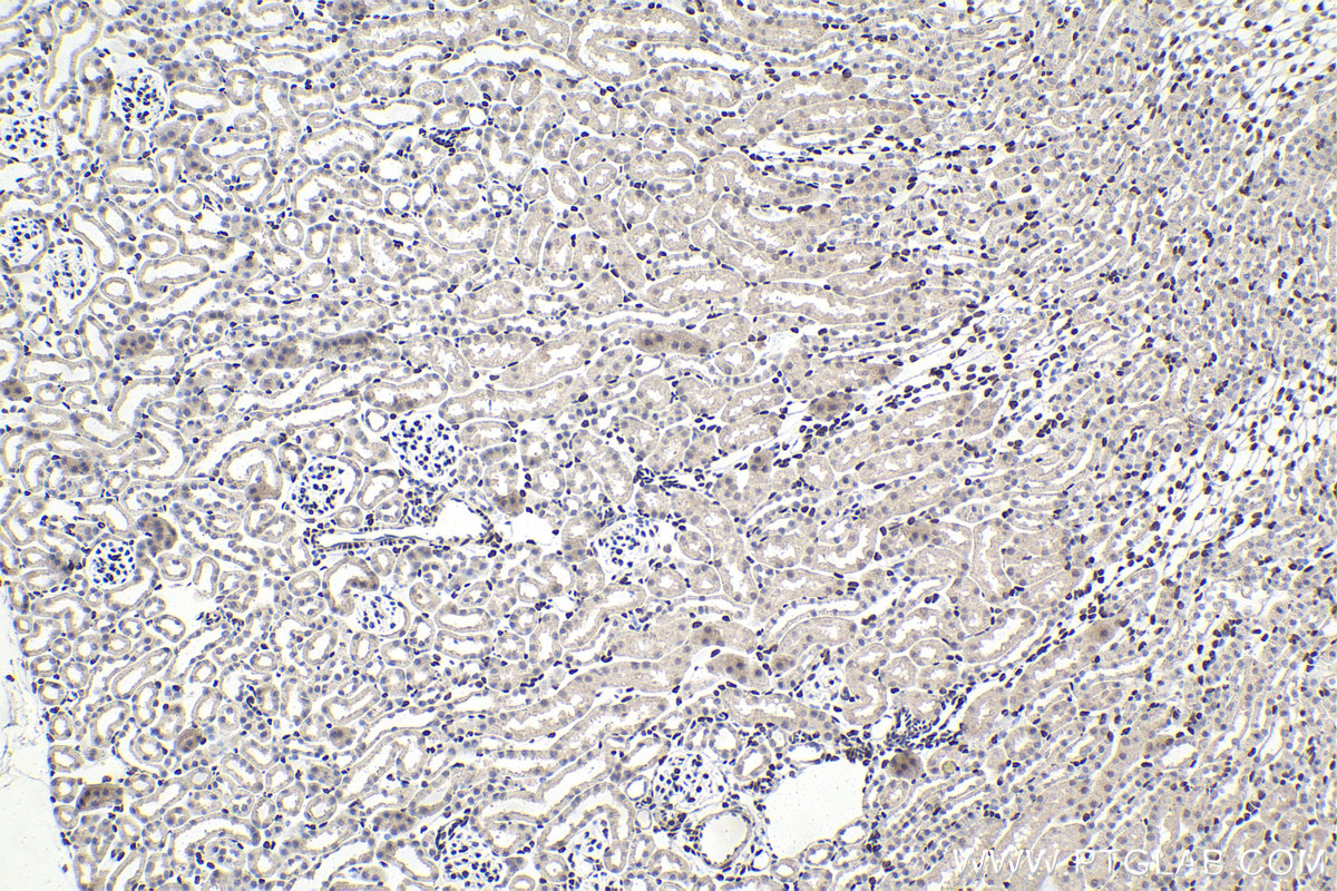 Immunohistochemistry (IHC) staining of mouse kidney tissue using PBX1 Polyclonal antibody (18204-1-AP)