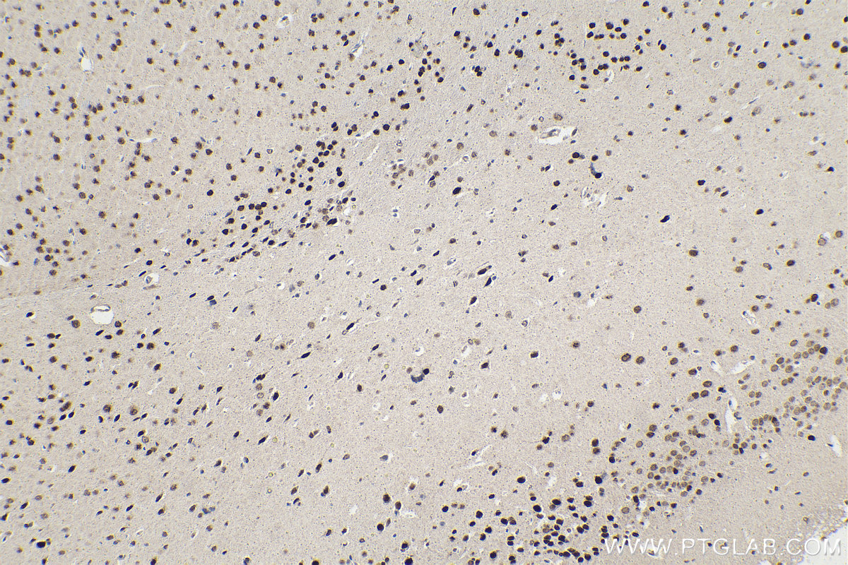 Immunohistochemistry (IHC) staining of mouse brain tissue using PBX1 Polyclonal antibody (18204-1-AP)