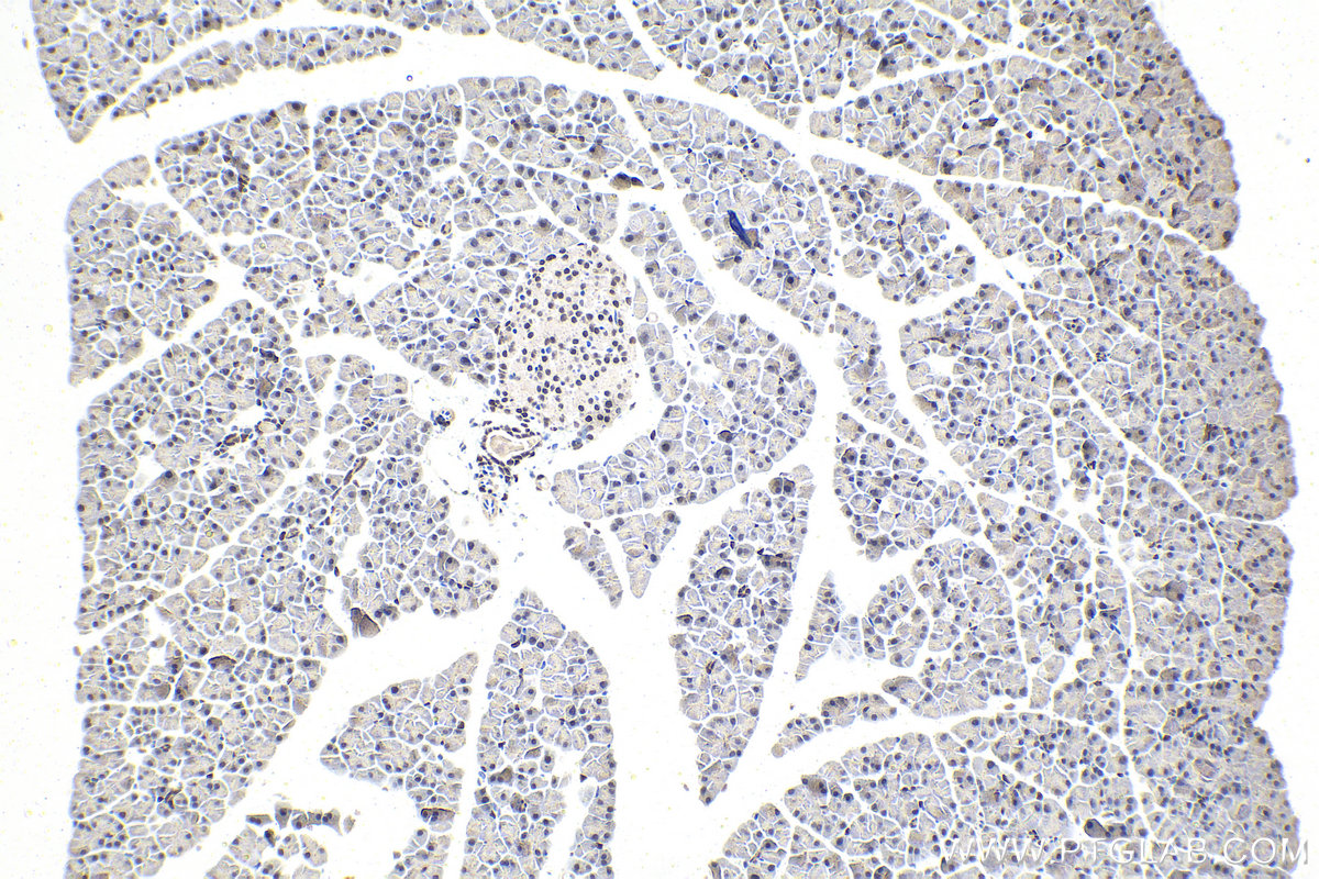 Immunohistochemistry (IHC) staining of mouse pancreas tissue using PBX1 Polyclonal antibody (18204-1-AP)