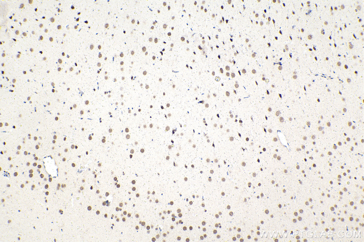 Immunohistochemistry (IHC) staining of rat brain tissue using PBX1 Polyclonal antibody (18204-1-AP)