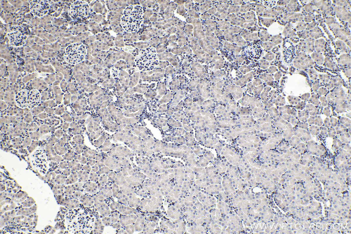 Immunohistochemistry (IHC) staining of rat kidney tissue using PBX1 Polyclonal antibody (18204-1-AP)