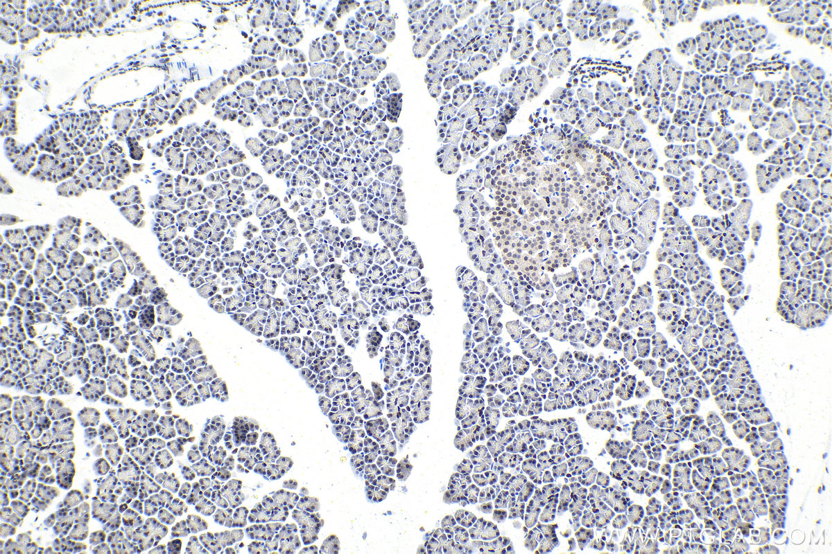 Immunohistochemistry (IHC) staining of rat pancreas tissue using PBX1 Polyclonal antibody (18204-1-AP)