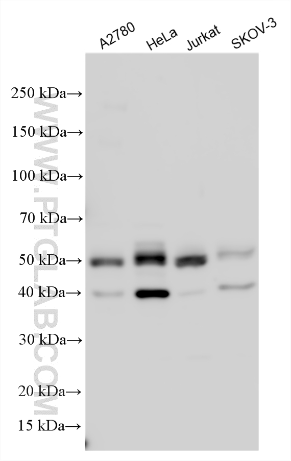 Western Blot (WB) analysis of various lysates using PBX1 Polyclonal antibody (18204-1-AP)