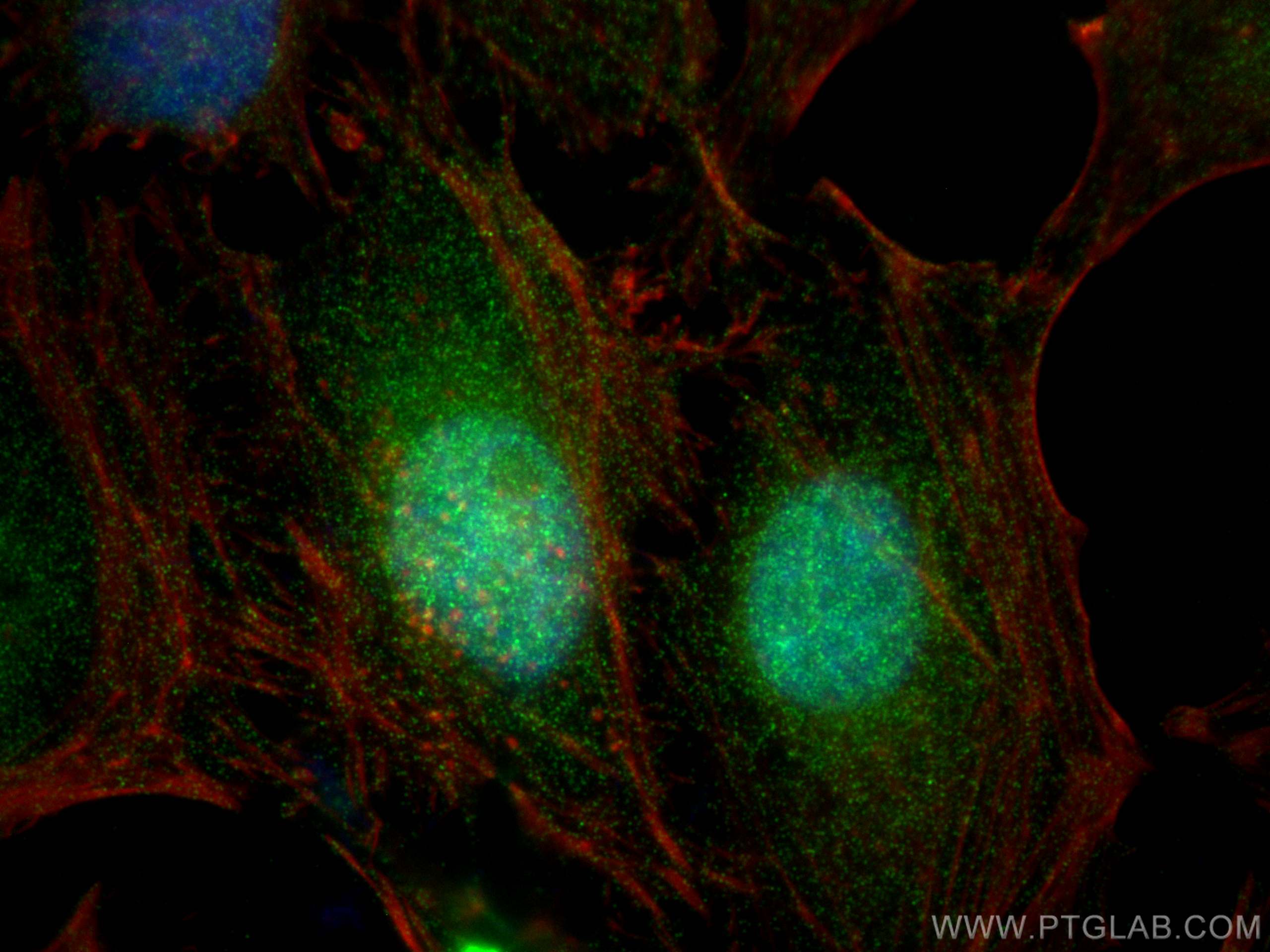 Immunofluorescence (IF) / fluorescent staining of HeLa cells using PCBD1 Polyclonal antibody (15702-1-AP)