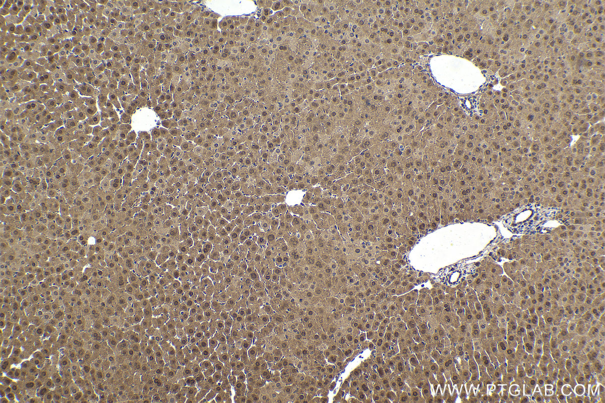 Immunohistochemistry (IHC) staining of mouse liver tissue using PCBD1 Polyclonal antibody (15702-1-AP)