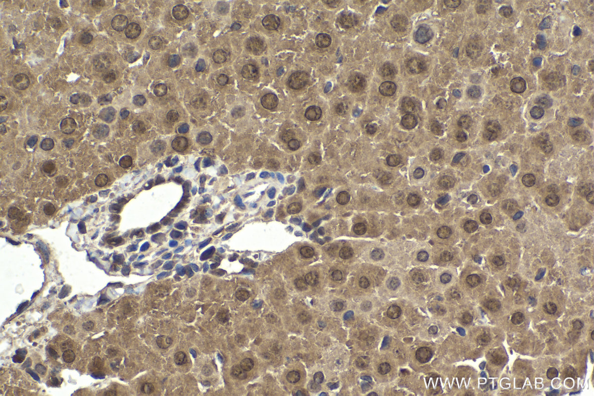 Immunohistochemistry (IHC) staining of mouse liver tissue using PCBD1 Polyclonal antibody (15702-1-AP)