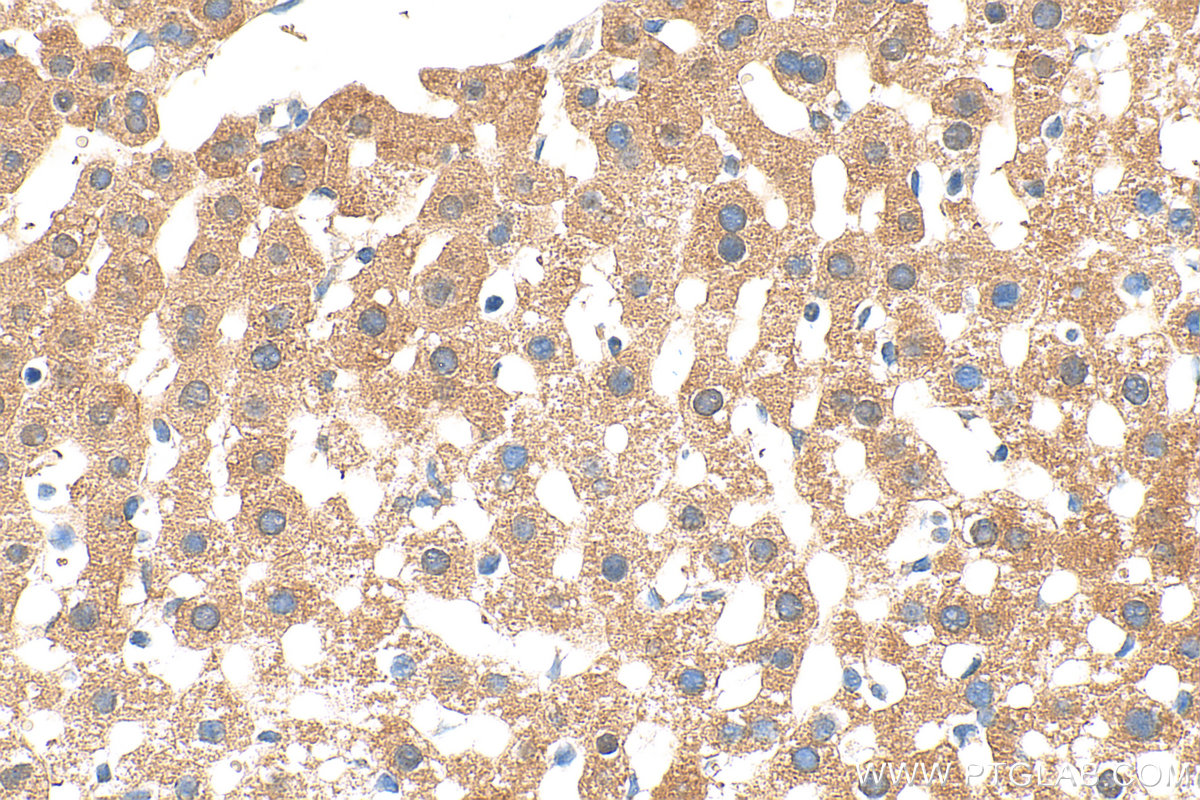 Immunohistochemistry (IHC) staining of mouse liver tissue using PCBD1 Polyclonal antibody (15702-1-AP)