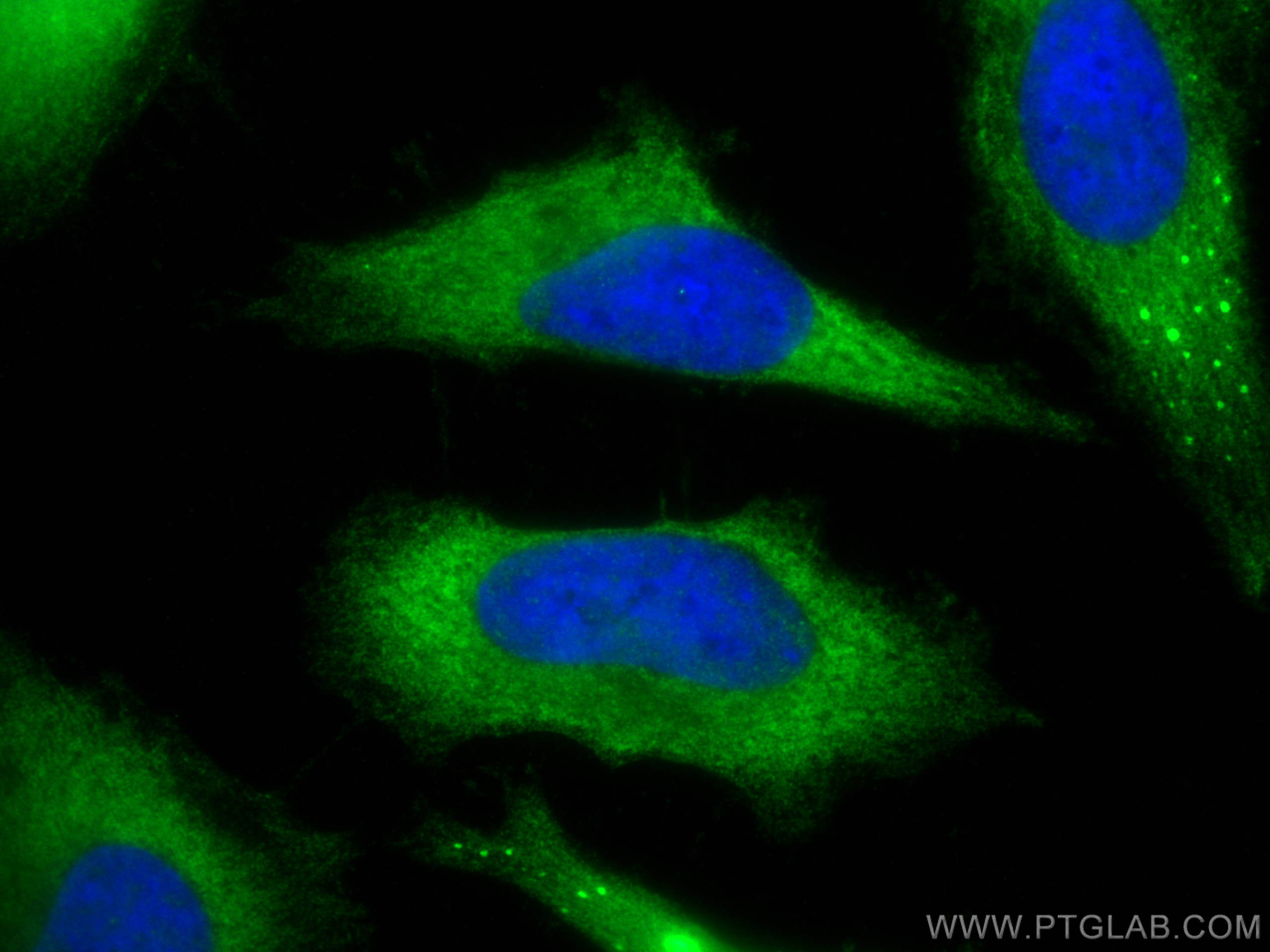 Immunofluorescence (IF) / fluorescent staining of HeLa cells using PCBP2 Polyclonal antibody (15070-1-AP)