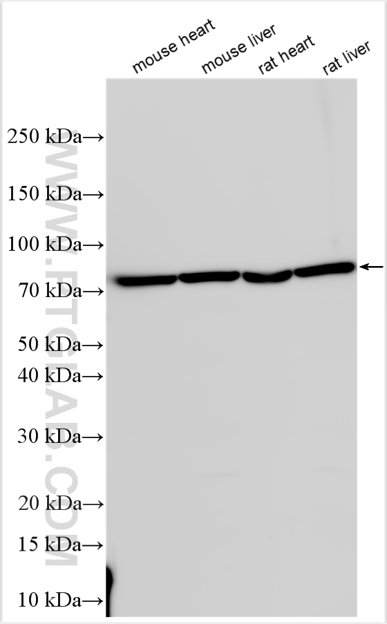 Western Blot (WB) analysis of various lysates using PCCA Polyclonal antibody (21988-1-AP)