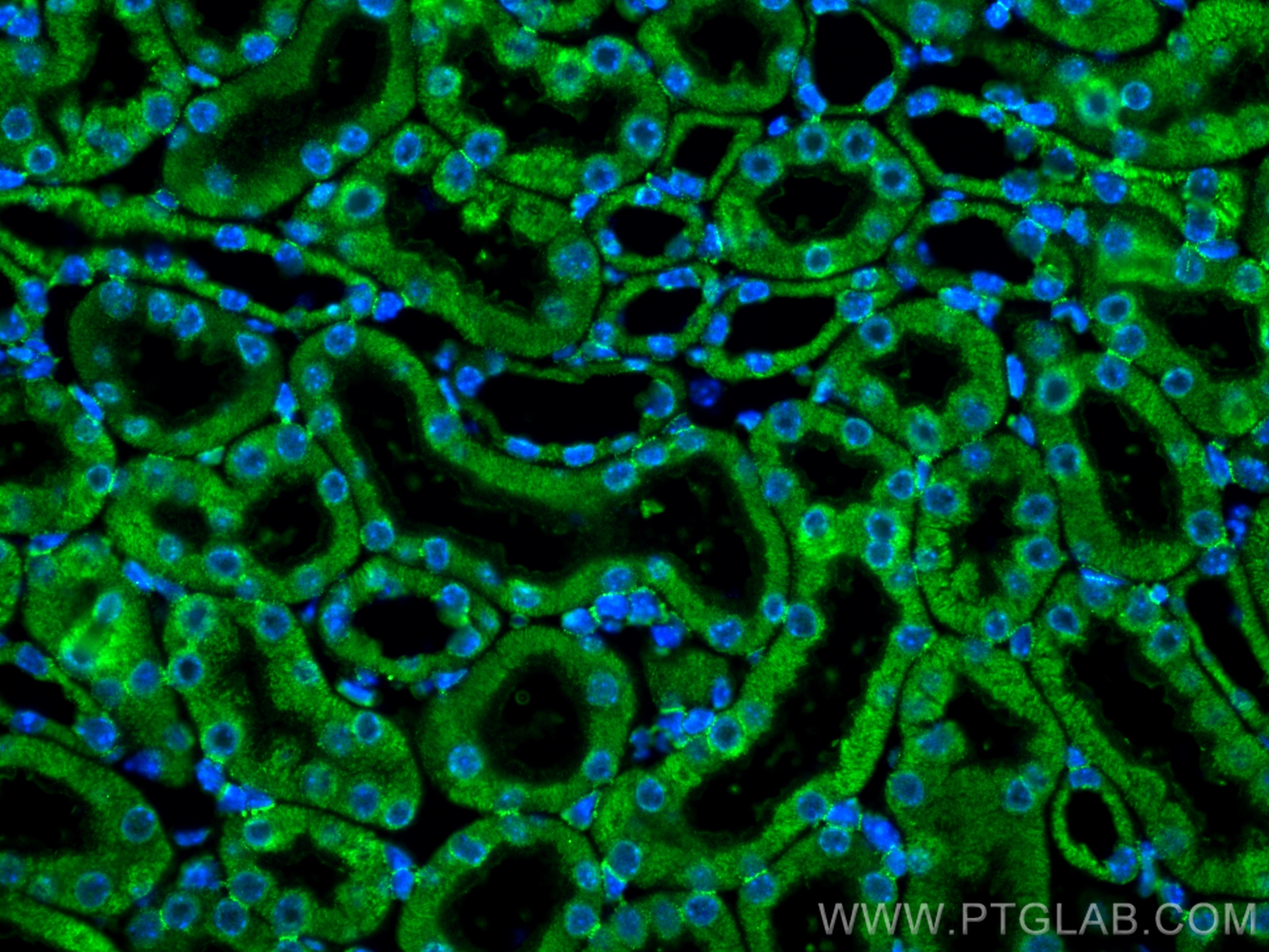 Immunofluorescence (IF) / fluorescent staining of mouse kidney tissue using PCCB Monoclonal antibody (66501-1-Ig)