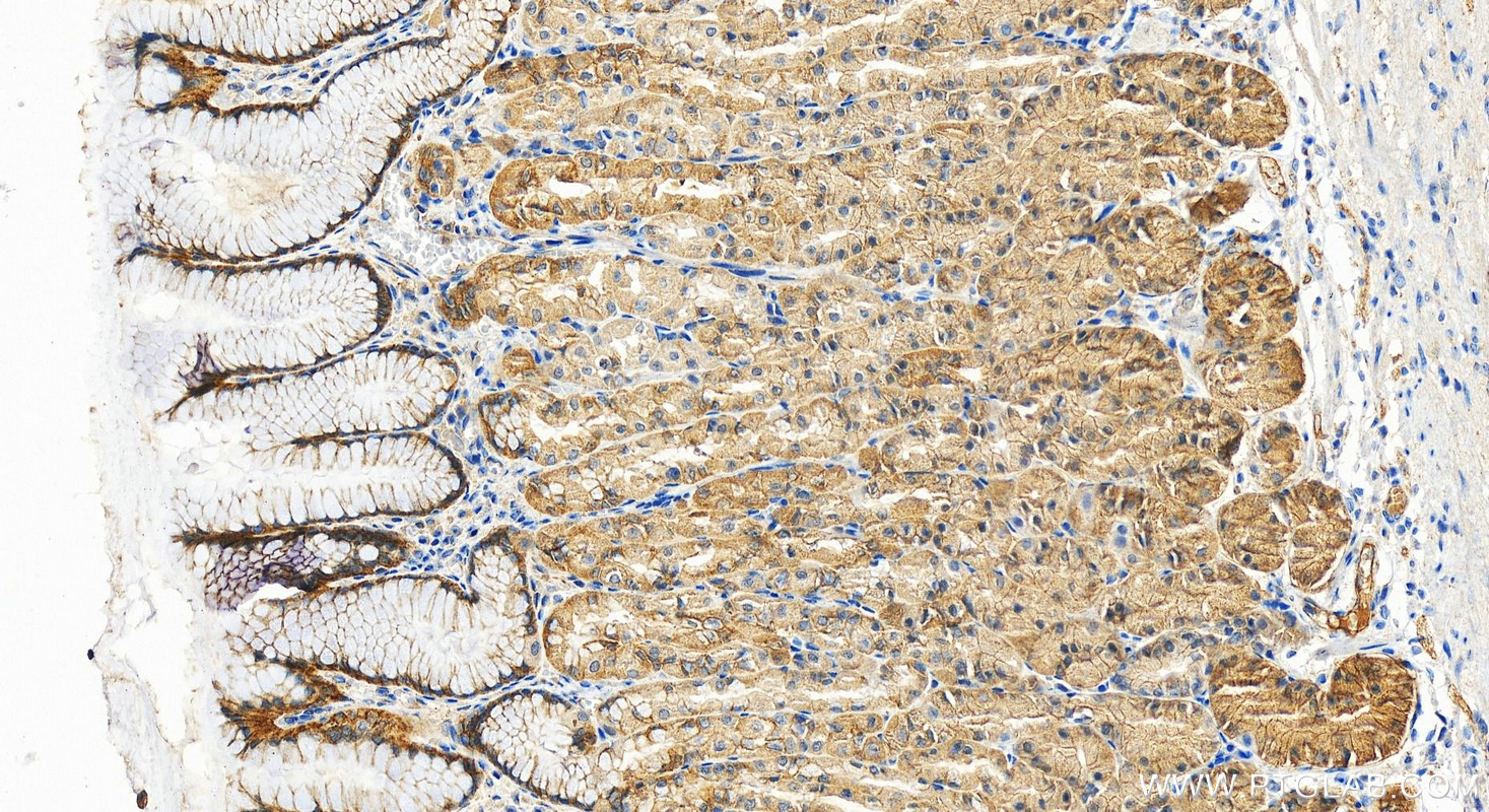 Immunohistochemistry (IHC) staining of human stomach tissue using PCDH1 Polyclonal antibody (13645-1-AP)