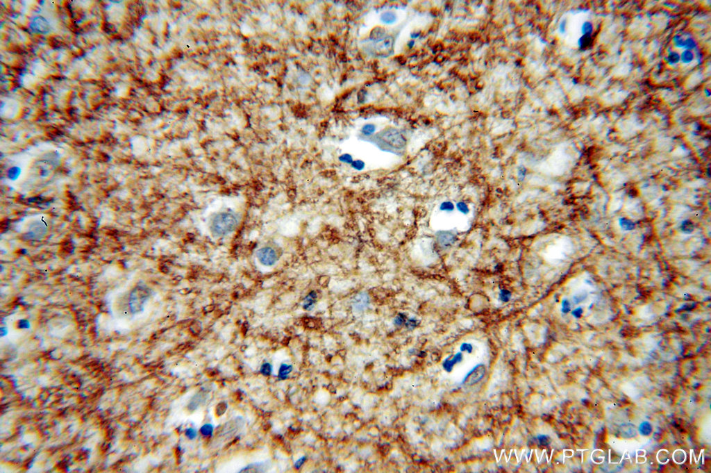 Immunohistochemistry (IHC) staining of human brain tissue using PCDH11X Polyclonal antibody (20070-1-AP)