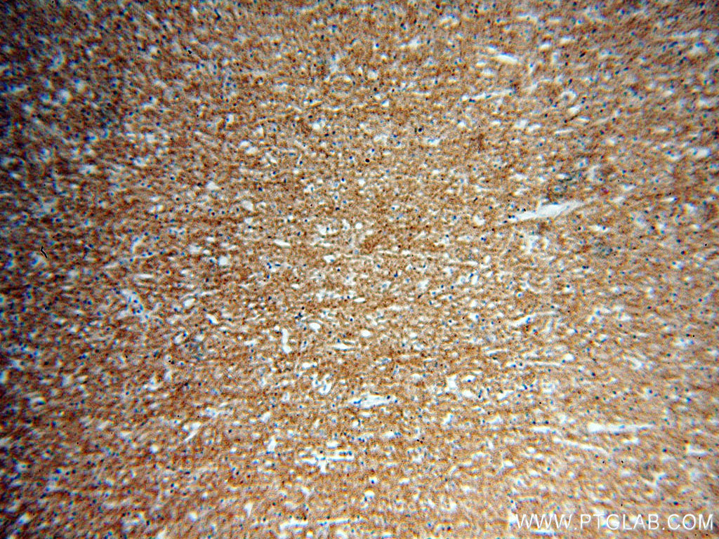 Immunohistochemistry (IHC) staining of human brain tissue using PCDHA3 Polyclonal antibody (18803-1-AP)