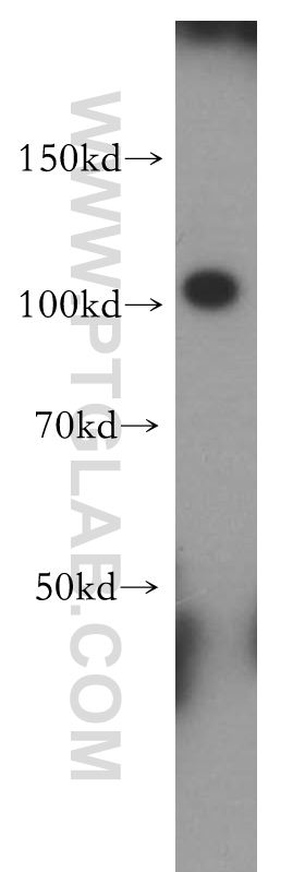 Western Blot (WB) analysis of mouse colon tissue using PCDHA3 Polyclonal antibody (18803-1-AP)