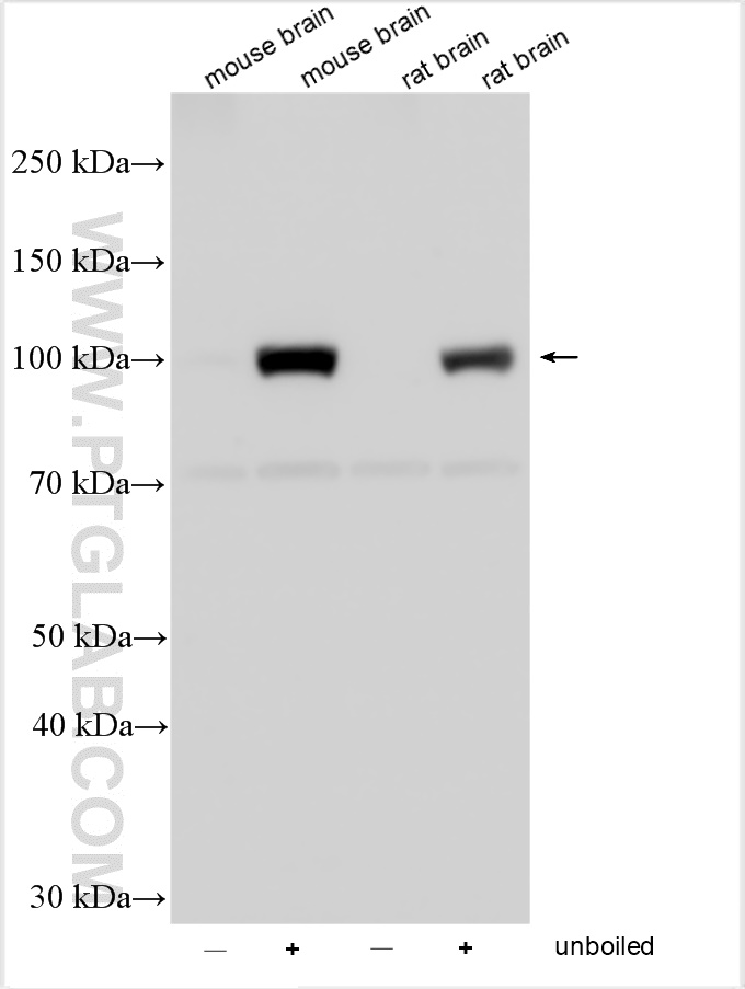 Western Blot (WB) analysis of various lysates using PCDHA5 Polyclonal antibody (15270-1-AP)