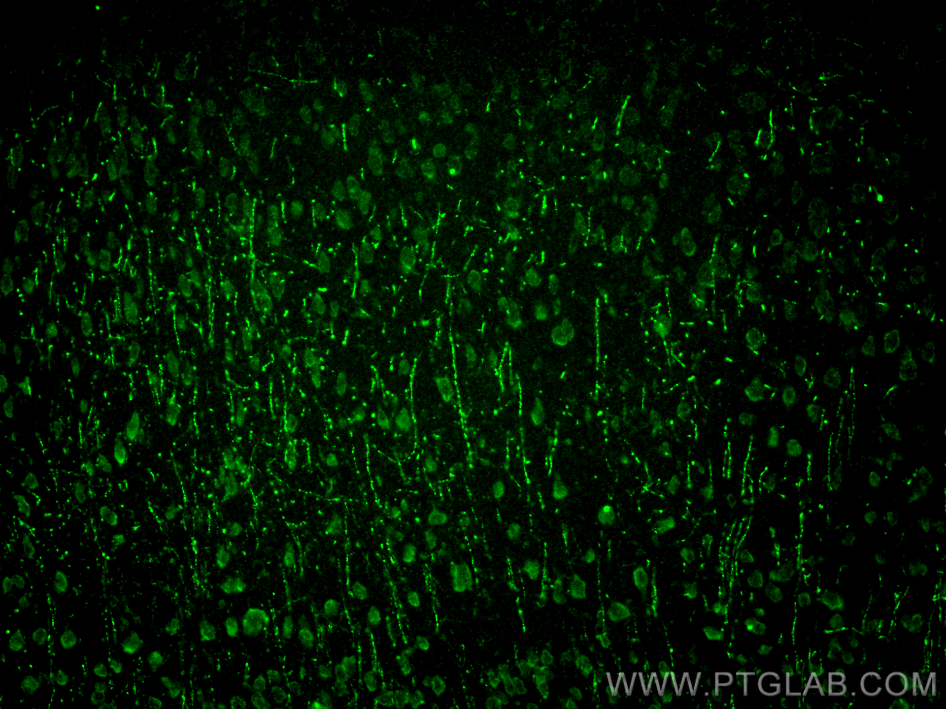 Immunofluorescence (IF) / fluorescent staining of mouse brain tissue using PCDHA9 Polyclonal antibody (18075-1-AP)