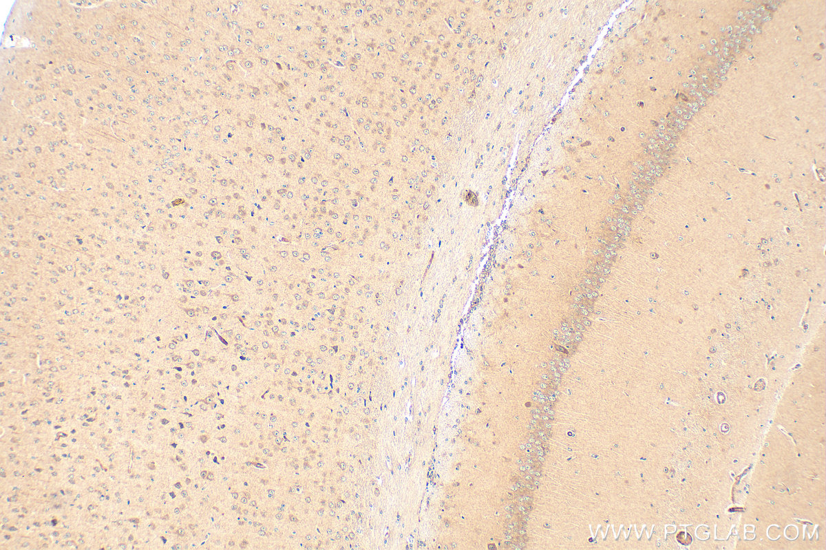 Immunohistochemistry (IHC) staining of mouse brain tissue using PCDHB13 Polyclonal antibody (17050-1-AP)