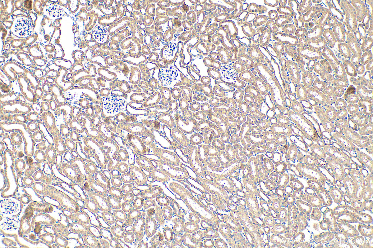 Immunohistochemistry (IHC) staining of mouse kidney tissue using PCDHGB3 Polyclonal antibody (21204-1-AP)