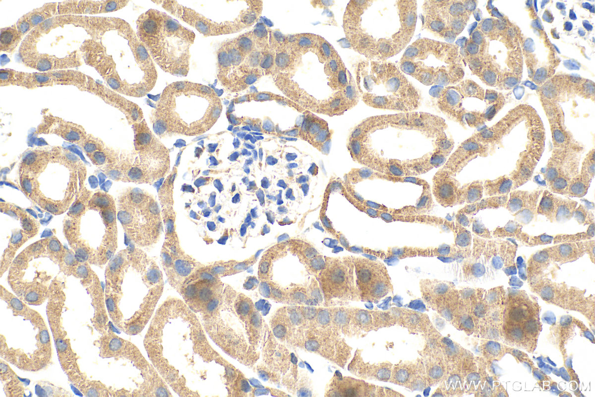 Immunohistochemistry (IHC) staining of mouse kidney tissue using PCDHGB3 Polyclonal antibody (21204-1-AP)