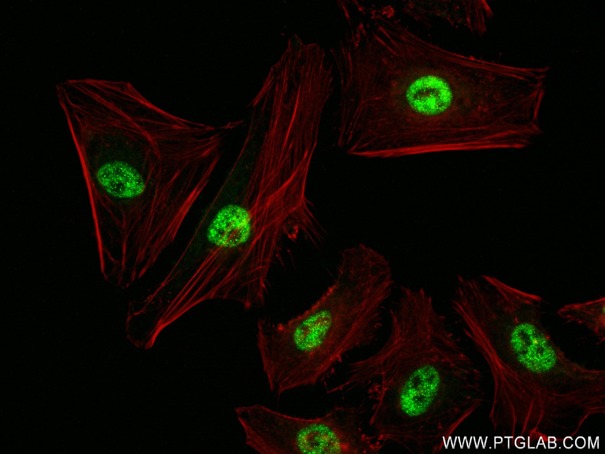 Immunofluorescence (IF) / fluorescent staining of HeLa cells using PCF11 Recombinant antibody (84081-5-RR)