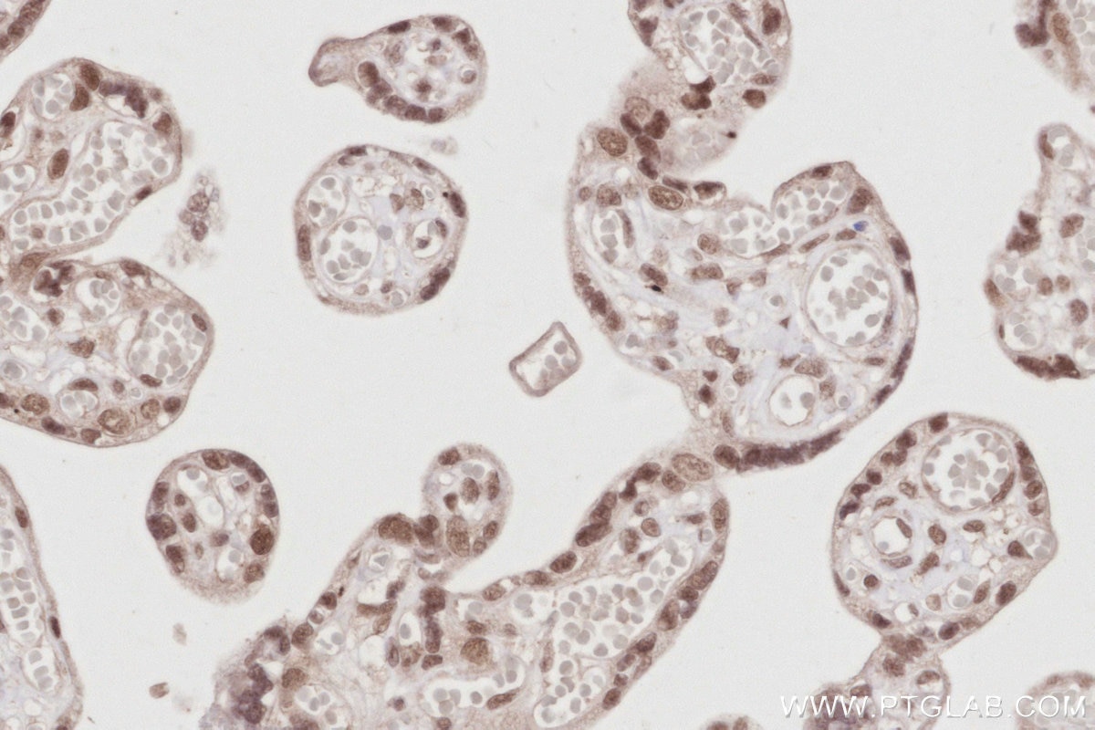 Immunohistochemistry (IHC) staining of human placenta tissue using PCGF6 Polyclonal antibody (24103-1-AP)