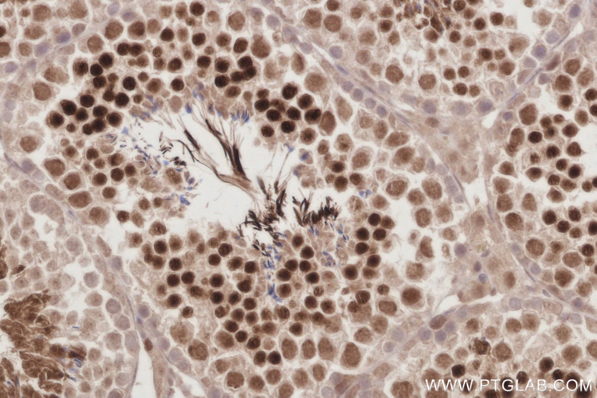 Immunohistochemistry (IHC) staining of mouse testis tissue using PCGF6 Polyclonal antibody (24103-1-AP)