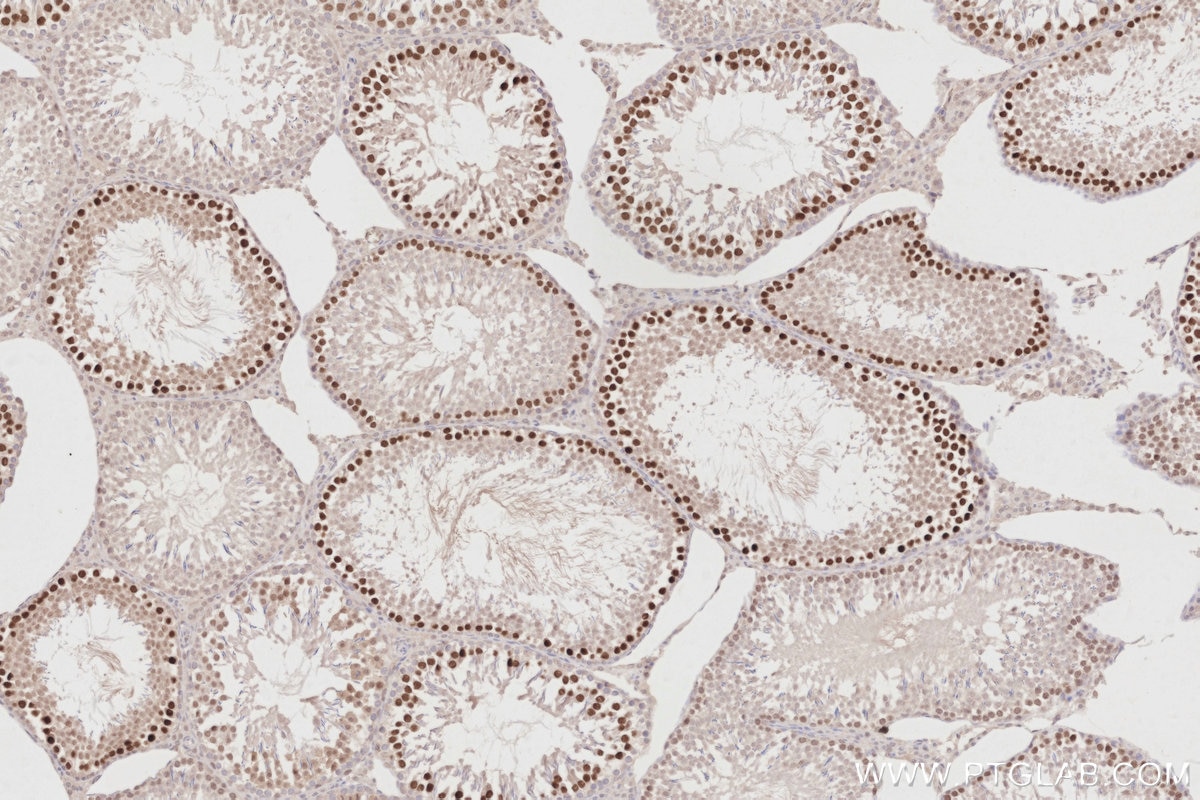 Immunohistochemistry (IHC) staining of rat testis tissue using PCGF6 Polyclonal antibody (24103-1-AP)