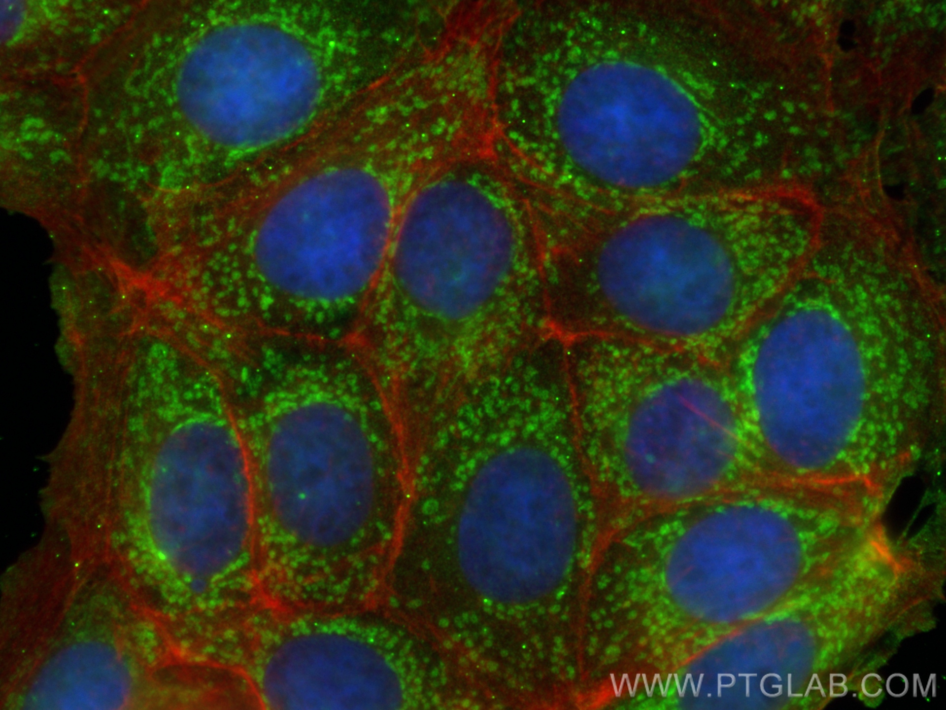 Immunofluorescence (IF) / fluorescent staining of MCF-7 cells using PCK2 Monoclonal antibody (67676-1-Ig)