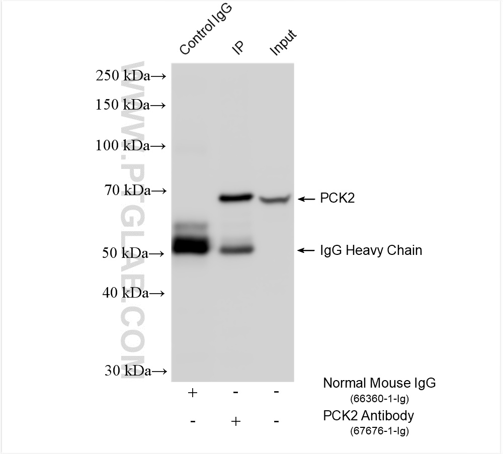 Immunoprecipitation (IP) experiment of HepG2 cells using PCK2 Monoclonal antibody (67676-1-Ig)