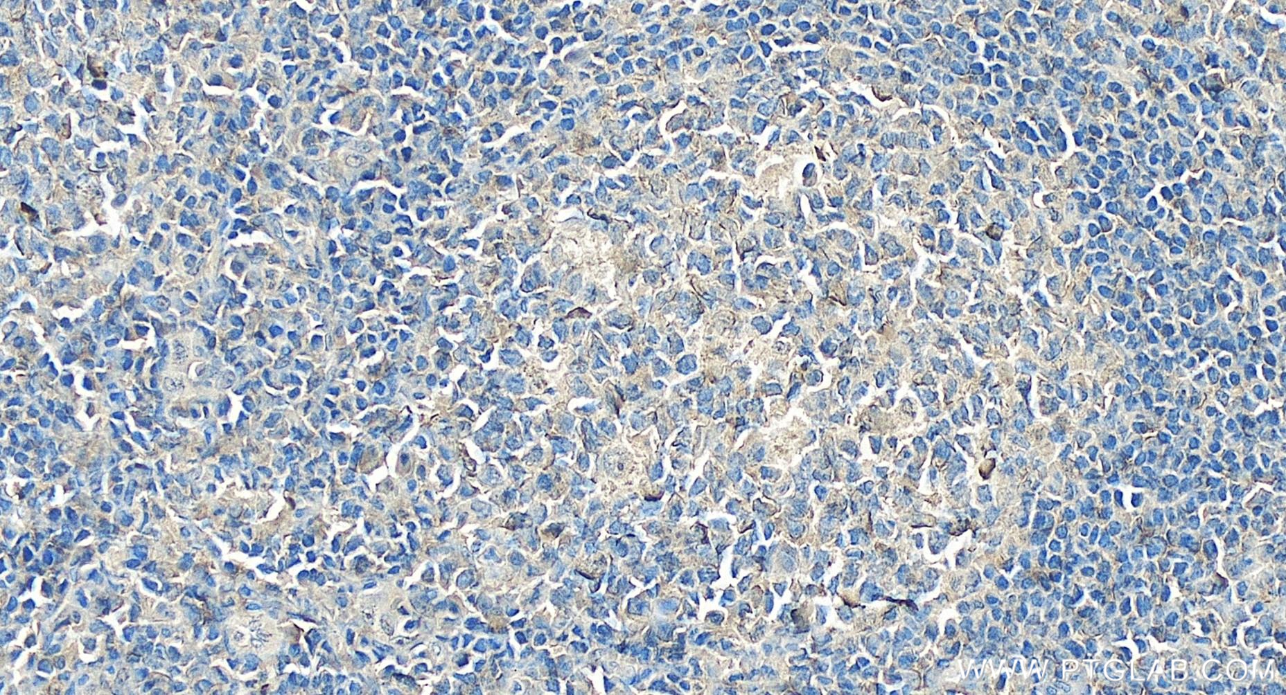 Immunohistochemistry (IHC) staining of human tonsillitis tissue using PCM1 Recombinant antibody (84979-1-RR)