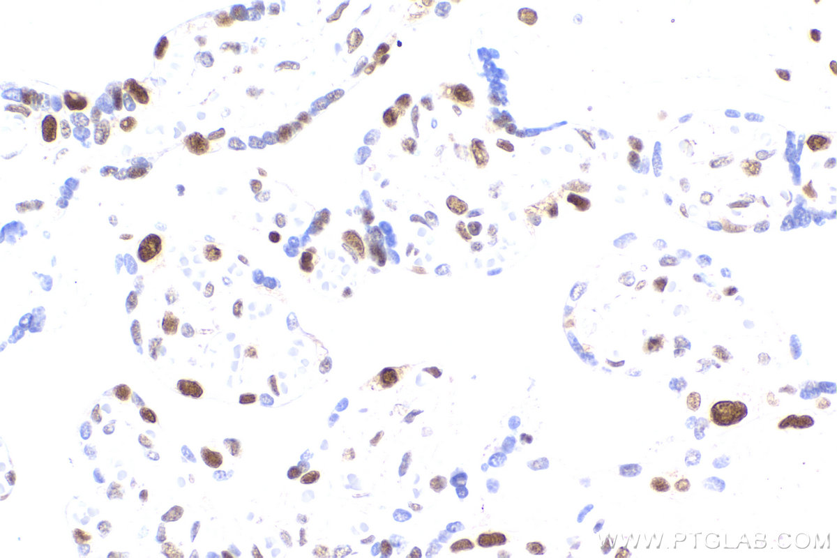 Immunohistochemistry (IHC) staining of human placenta tissue using PCNA Monoclonal antibody (60097-1-Ig)