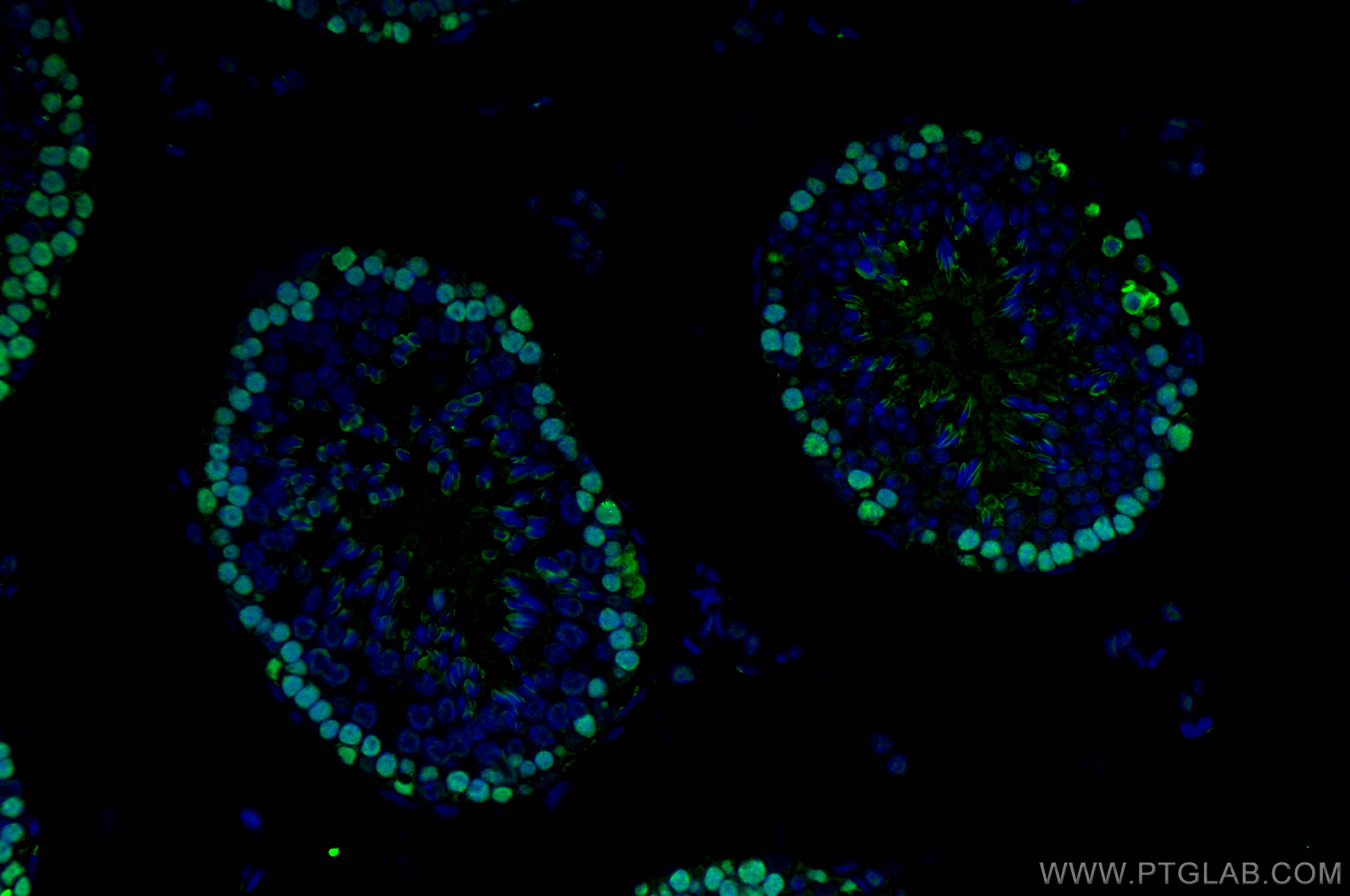 Immunofluorescence (IF) / fluorescent staining of mouse testis tissue using PCNA Recombinant antibody (81302-6-RR)