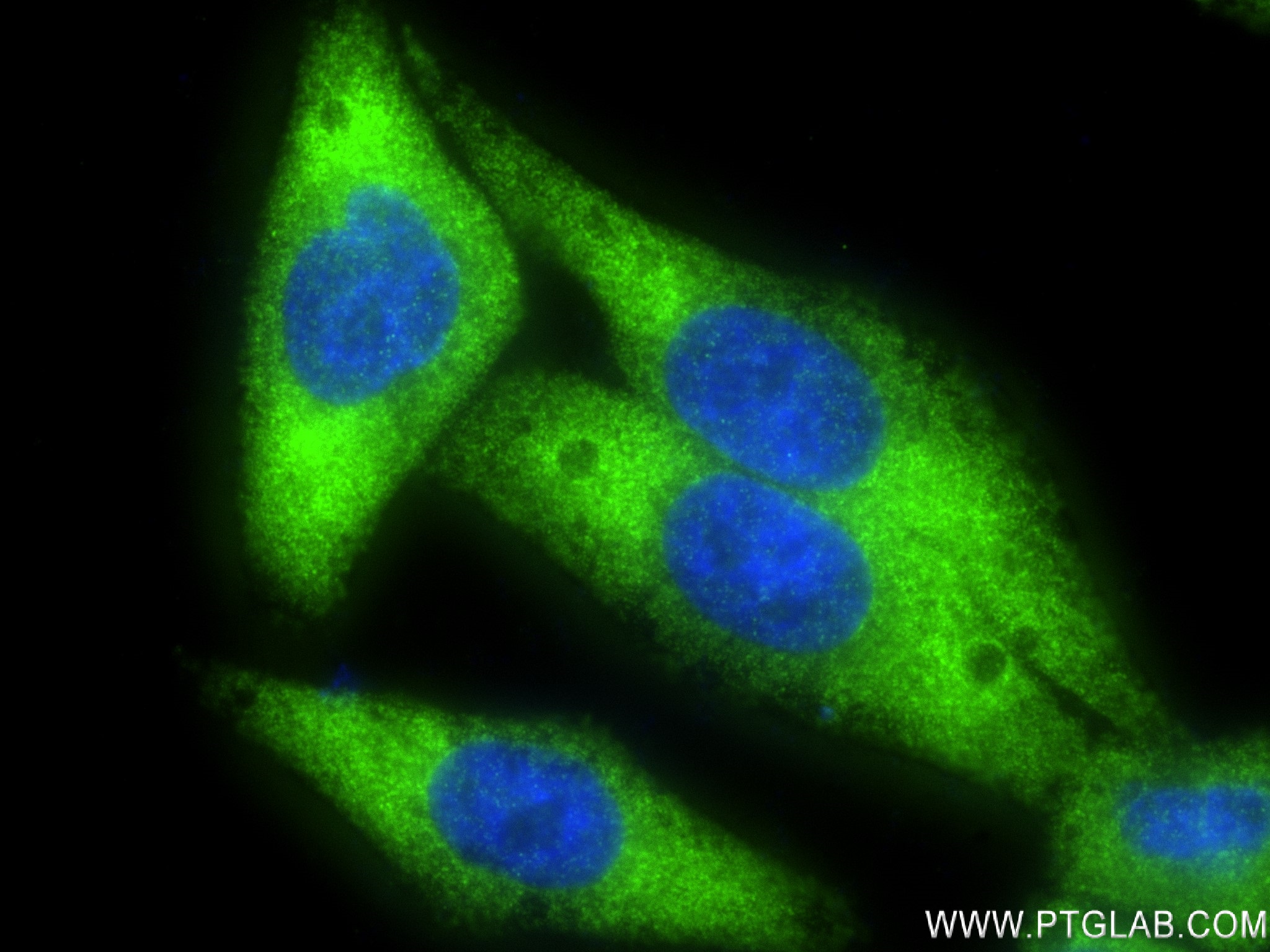 PCSK9 antibody (83004-4-RR) | Proteintech