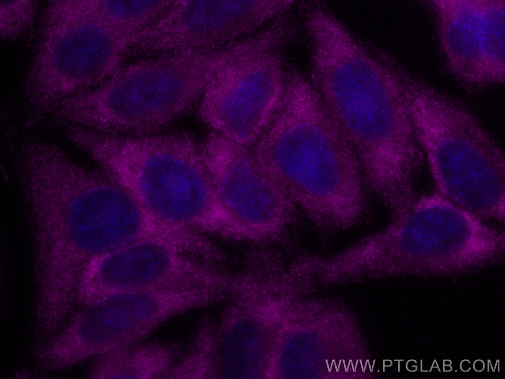 Immunofluorescence (IF) / fluorescent staining of HepG2 cells using CoraLite® Plus 647-conjugated PCSK9 Recombinant an (CL647-83004-4)