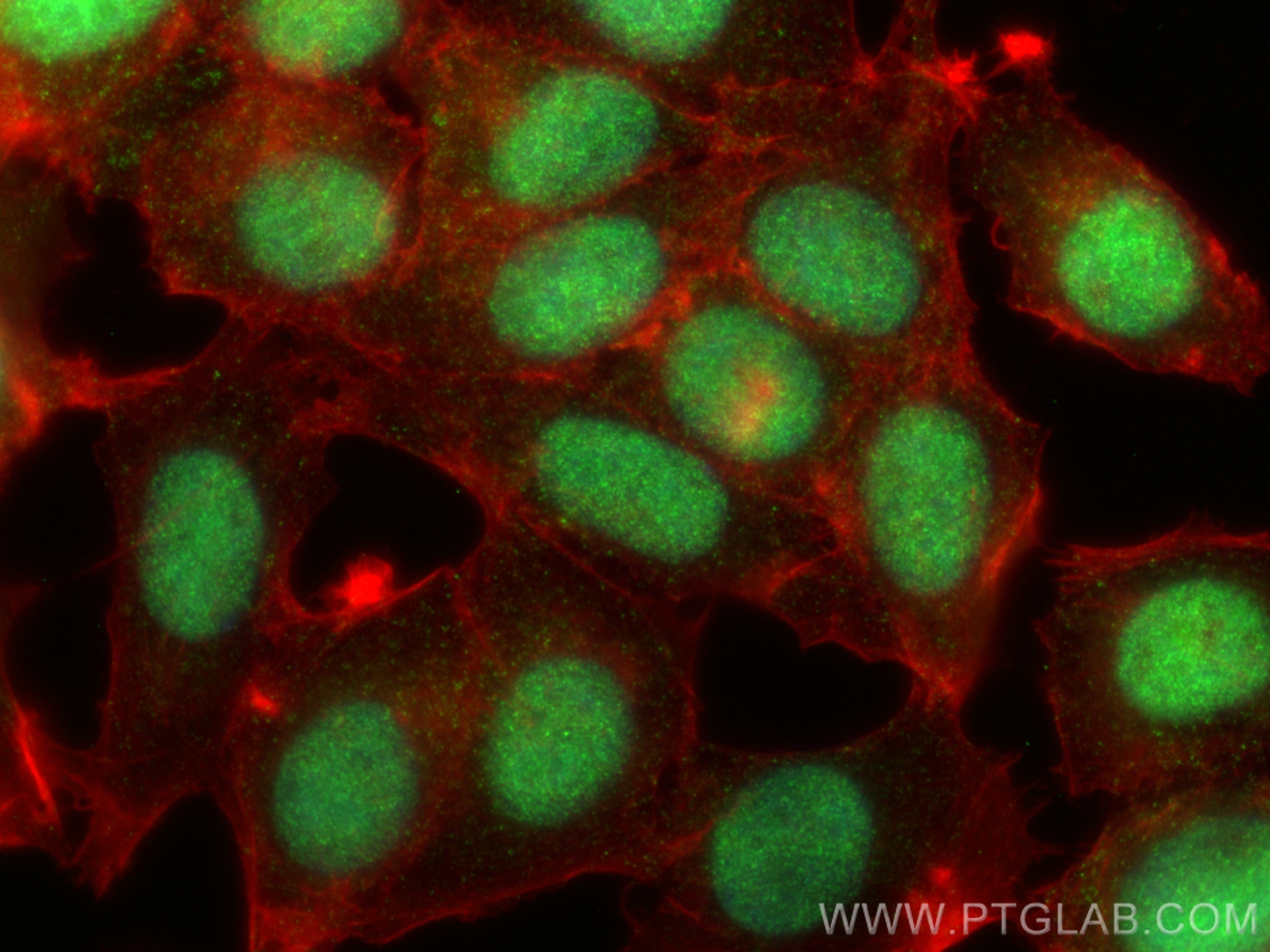 Immunofluorescence (IF) / fluorescent staining of MCF-7 cells using PCYT1A Recombinant antibody (83100-1-RR)