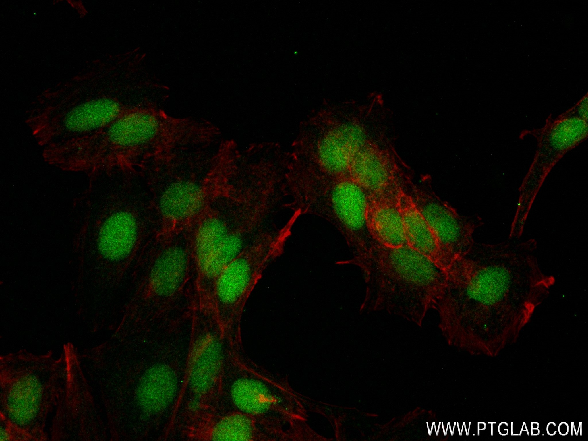 Immunofluorescence (IF) / fluorescent staining of MCF-7 cells using PCYT1A Recombinant antibody (83100-1-RR)