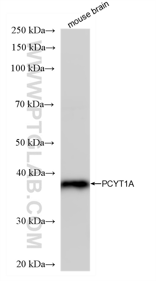 Western Blot (WB) analysis of various lysates using PCYT1A Recombinant antibody (83100-1-RR)