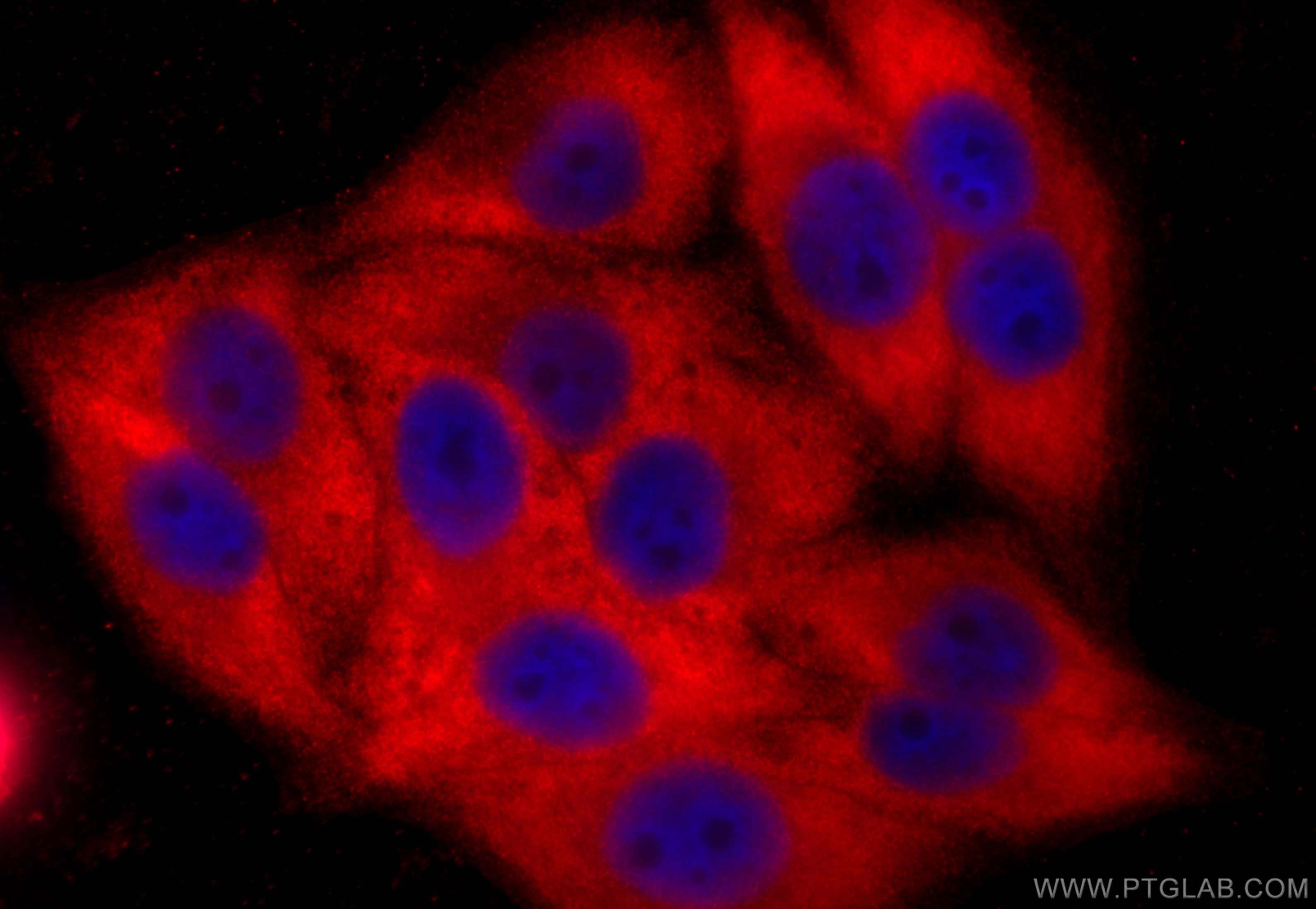 Immunofluorescence (IF) / fluorescent staining of HepG2 cells using PCYT2 Polyclonal antibody (14827-1-AP)