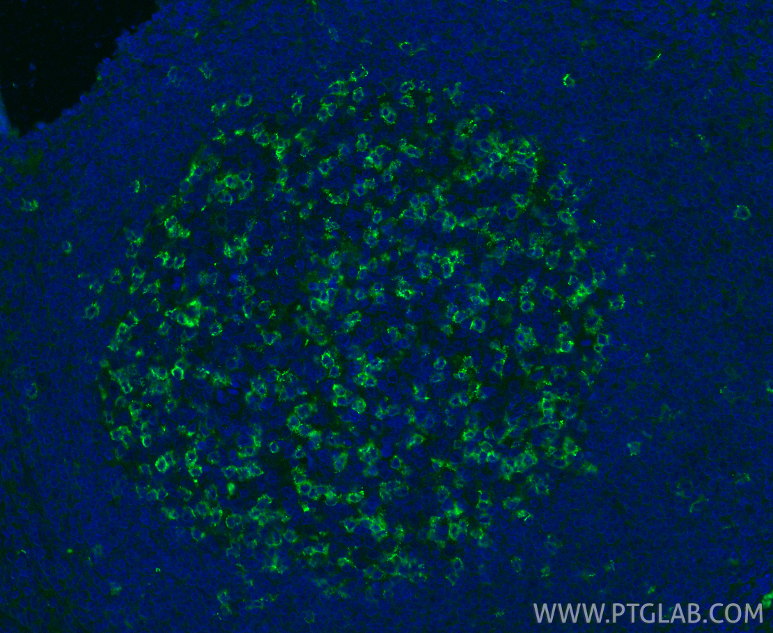 Immunofluorescence (IF) / fluorescent staining of human tonsillitis tissue using PD-1/CD279 Monoclonal antibody (66220-1-Ig)