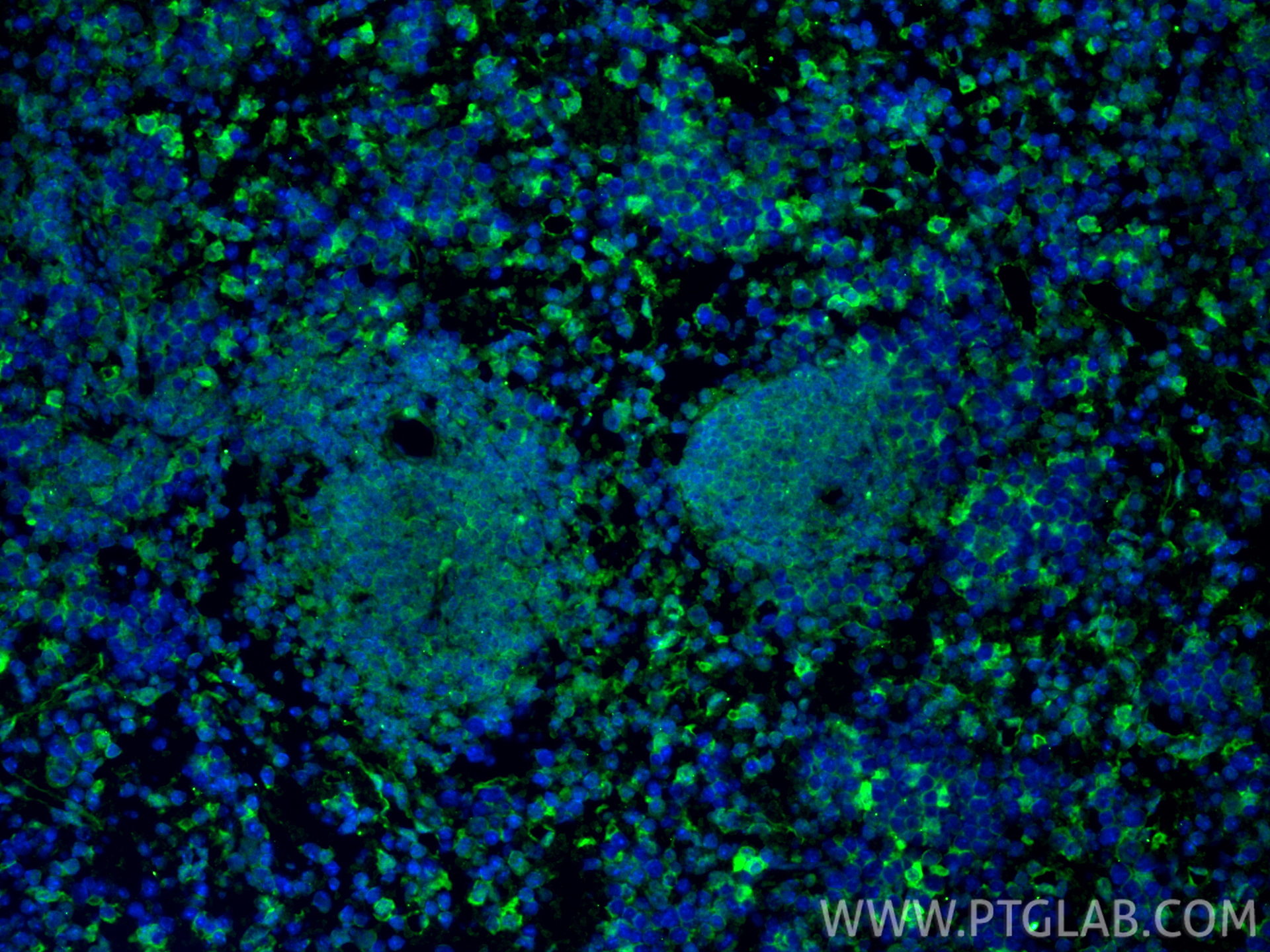 Immunofluorescence (IF) / fluorescent staining of mouse spleen tissue using PD-1/CD279 Monoclonal antibody (66220-1-Ig)